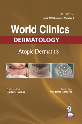 World Clinics: Dermatology: Atopic Dermatitis - Sarkar, Rashmi, and Larralde, Margarita