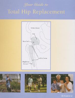 Your Guide to Total Hip Replacement - Fairview Health Services (Creator)